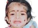 ಯೋಕ್ಷಾ ಶೆಟ್ಟಿ ಪುಟ್ಟ ಮಗು ಉಳಿಸಲು ನೆರವಿಗೆ ಮೊರೆ