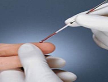 Blood test for multiple sclerosis comes closer