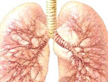 Early detection can raise lung cancer survival rate