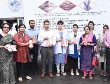Kasturba Hospital's 'Vitiligo Awareness Campaign' flagged off at Manipal