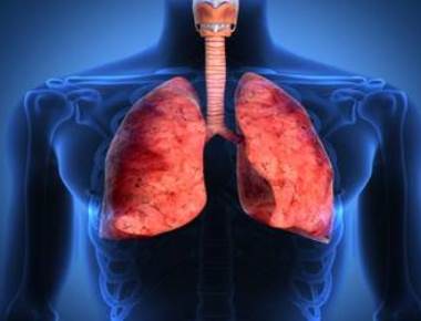 Triple therapy to help fight deadly lung cancer